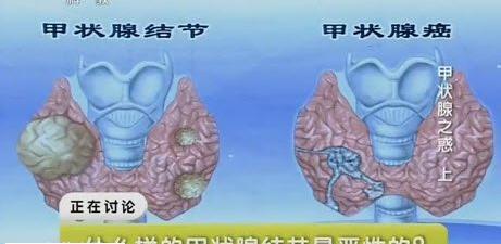 2018人保车险优惠政策